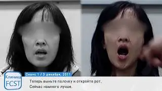 Пример лечения невралгии тройничного нерва