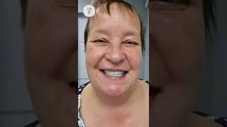 Улыбку больше не нужно прятать рукой. Имплантация зубов.