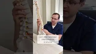 Hernia de disc 