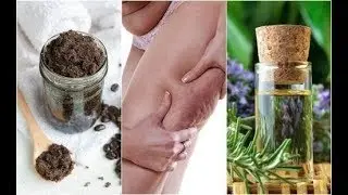 Vijf natuurlijke middelen tegen cellulitis: probeer ze!