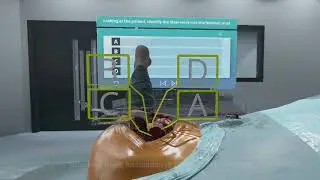 Posterior Total Hip Replacement - VR Simulation