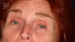 The Eye Love Project
