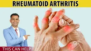 Simple Tips To Avoid Pain and Stiffness of Rheumatoid Arthritis