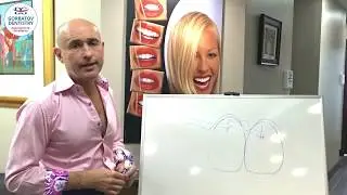 Керамические виниры в стоматологической клинике в Майами, Флорида США