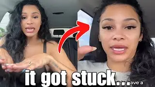 He Tried to Clap Her Cheeks For 10 Years & The UNTHINKABLE Happened