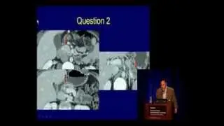 Tyler Stevens, MD, Cleveland Clinic GI Board Review Pancreas & Biliary Tract Questions