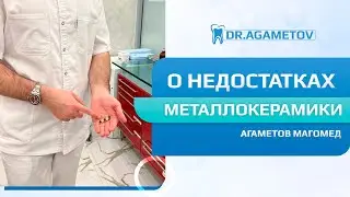Топ 4 недостатка металлокерамики. Почему я не делаю металлокерамические коронки.