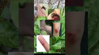 Plantain Spray's Impressive Pain Relief for Bites & Scrapes (Plantain Part 2)