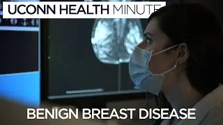 UConn Health Minute: Benign Breast Disease