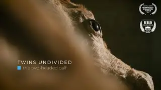 Twins Undivided: The Two-Headed Calf