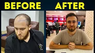 This YouTube Automation Niche is Unexplored