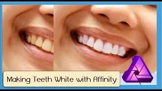 How to Whiten Teeth in Affinity Photo
