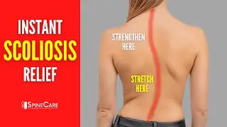 Best Scoliosis Exercises for Pain and Posture (NO EQUIPMENT!)