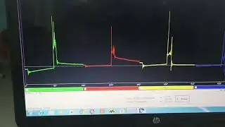 Калина двигатель троит, поиск неисправности, мотор тестером.