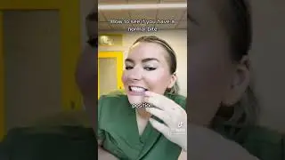 Do this to see if you have a class 1 bite #doctor #nyc #braces #invisalign #class1bite