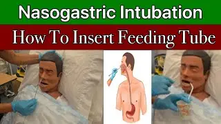 Nasogastric Intubation (NG Tube) | How To Insert Nasogastric Tube or Feeding Tube