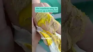 The Easiest Way to Clean up a Diaper Blowout  