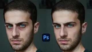 Under Eye Darkness Removal Photoshop