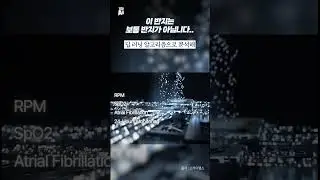 이 반지는보통 반지가 아닙니다..
