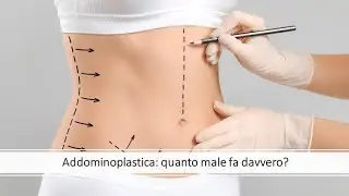 Addominoplastica, quanto male fa davvero? || Dr Paolo Montemurro - Chirurgo Plastico