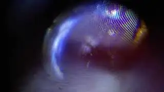 magnified bsf eyes (18+)
