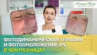 Фотодинамическая терапия и фотоомоложение IPL: в чём отличие? (розацеа, купероз, красное лицо)