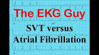 EKG/ECG - SVT vs Atrial Fibrillation | The EKG Guy - www.EKG.md