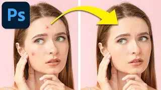Pickel entfernen in Adobe Photoshop - Tutorial Deutsch (2023)