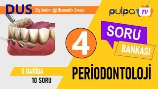 DUS SORU BANKASI / Periodontoloji Soruları - 4