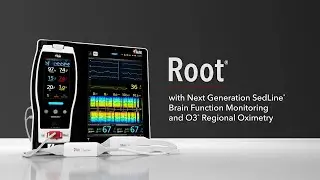 Root®, Patient Monitoring and Connectivity Platform, with Brain Monitoring