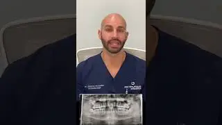 Wisdom Teeth. Do We Extract Before Invisalign?