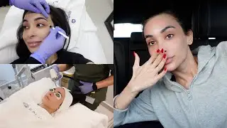 MY 1 MONTH WEDDING MAINTENANCE