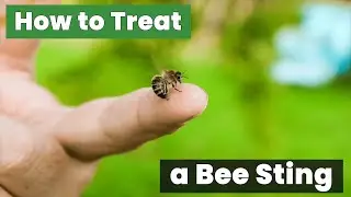 How to Treat a Bee Sting: Quick and Easy Method