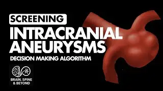How to Counsel Patients for Intracranial Aneurysms Screening? Best Decision Making Algorithm