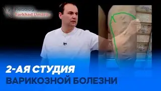 2-ая студия варикозной болезни