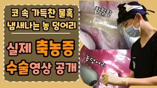 축농증수술 어떻게 진행될까?