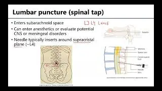 Back and Spinal Cord LO 5 - Meninges: Clinical Procedures