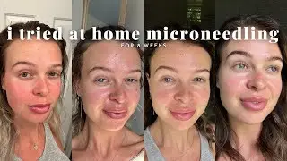 at home microbneeding | 8 weeks