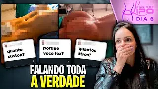 FALANDO A VERDADE SOBRE MINHA LIPO! 😱 |*sem esconder nada!*