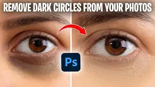 How to remove dark circle from face in photoshop || Photoshop advance tutorial in hindi