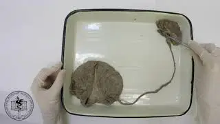Спланхнология, анатомия мочеточника