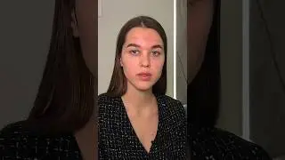 @dr.kuzhel.k Подписывайся!🦷 #dentist