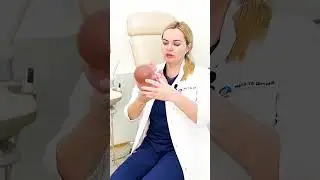 Пологи в тазовому передлежанні