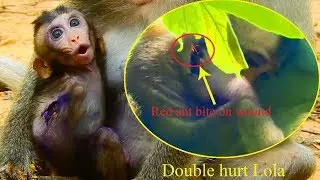 Billion pity Lola hurt arm cry super loud and double hurt by red ant bite on her wound / Monkey Post