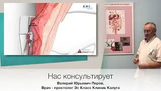 Лечение геморроя за один час в Калуге