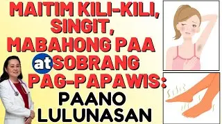 Maitim Kili-kili, Singit, Mabahong Paa at Sobrang Pag-papawis: Paano Lulunasan - By Doc Liza Ong
