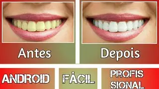 Como branquear os dentes - Android - PicsArt