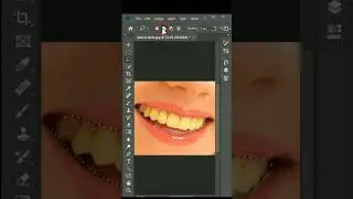 Teeth Whitening in Photoshop 