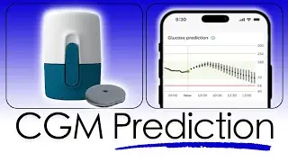 This CGM Predicts Glucose Levels - Accu-Chek SmartGuide