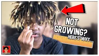 Why Your Dreads Aren’t Growing | Dreadlocks